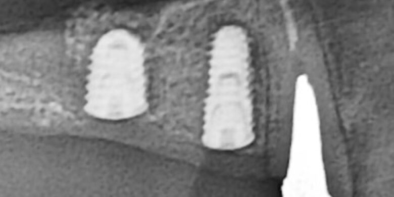 スクリーンショット 2023-08-22 15.25.22