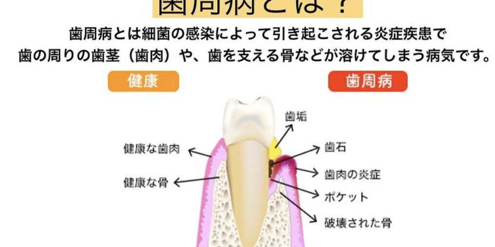 スクリーンショット 2023-10-18 21.19.22